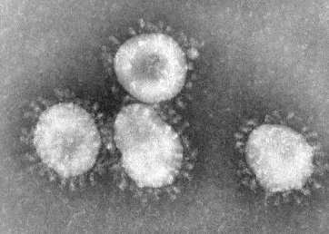 Chřipkové viry Flu viruses Nechřipkové respirační viry Non-flu