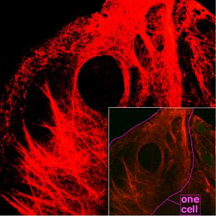 Fluorescenčně obarvená intermediární filementa z keratinu;