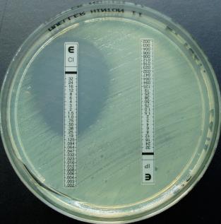 Metodika stanovení citlivosti metody: diskový difuzní test diluční test v bujonu diluční test v agaru E-test standardy: - mezní hodnoty - popis metodiky -