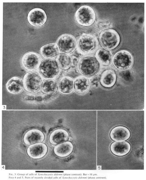 složení chlorofylů nejde tedy o předchůdce vyšších rostlin Dnes řazeny k sinicím Některé známé rody: Prochloron (viz