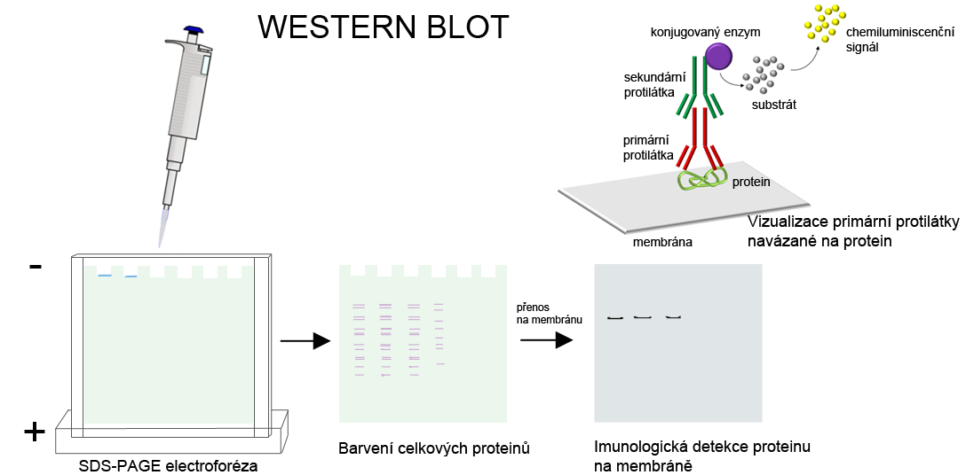 PŘÍPRAVA VZORKŮ Lyzační pufry. Pro přípravu vzorků pro Western blot jsou využívány lyzační pufry, které uvolní a rozpustí proteiny obsažené v testovaných buňkách a tkáních.