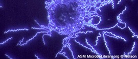 1. Borrelia burgdorferi Sensu Lato Real Time PCR souprava pro průkaz nukleové kyseliny (DNA) Borrelia burgdorferi Sensu Stricto, B. afzelii a B.