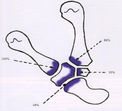 Obr. 14 radiologytutorials.com Obr. 15 Trtík, 2011 1. stupeň 2. stupeň 3.