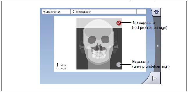 CEPHALOMETRICKÉ SNÍMKOVÁNÍ 5.3 Polohování pacienta v posteriorní anebo anteriorní projekci 1. Vyberte posterioranterior program z rozbalovacího menu na horní straně obrazovky. Opěrka hlavy 2.