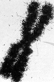 Metafázický chromozom dosahuje maximální kondenzace a zkrácení (10 µm, tomu odpovídá 100 km 15 m) velikost určena celkovou délkou chromozomu centromera dělí chromozom na