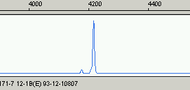 Prokluz