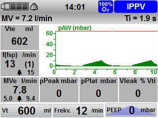 3 Popis 3.3.2 Ventilační režim (příklad) 1 2 3 4 5 25 24 6 7 8 23 22 9 10 11 21 12 20 19 18 17 13 16 15 14 3-4 Displej ve ventilačním režimu IPPV v zobrazeních 1 (Manometr, měř.