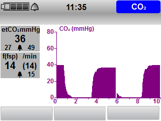 4 Příprava a obsluha 4.7.8 Provádění monitorování CO 2 (pouze při volitelné možnosti Kapnografie) Předpoklad Přístroj je zapnutý.