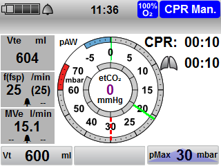 4 Příprava a obsluha 2. Je-li to zapotřebí: Pravým navigačním knoflíkem změnit rytmus: 30:2 15:2 Kontinuální 3.