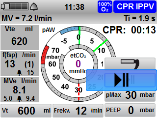4 Příprava a obsluha Pauza umělého dýchání v režimu CPR Během analýzy defibrilátoru můžete v umělém dýchání udělat pauzu, aby se zabránilo artefaktům při analýze. Předpoklad Přístroj je zapnutý.