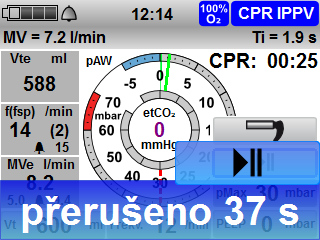 4 Příprava a obsluha 3. Pro opětovné spuštění ruční ventilace: Dvakrát stisknout pole Pauza. Výsledek Pauza umělého dýchání. Po uběhnutí odpočtu se umělé dýchání automaticky znovu spustí. 4.7.