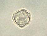 Acanthamoeba spp.