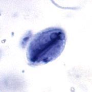 Giardia