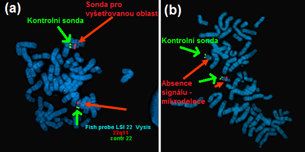 V důsledku komplementarity bází se hybridizuje k předem známému úseku, jehož přítomnost je poté zjištěna během vyhodnocení signálů za použití fluorescenčního mikroskopu.