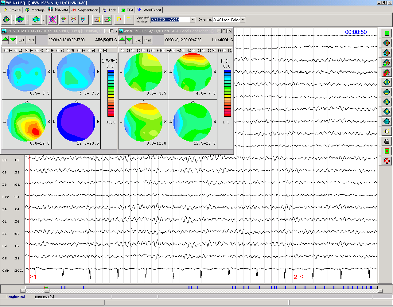 CMP - pravostranná