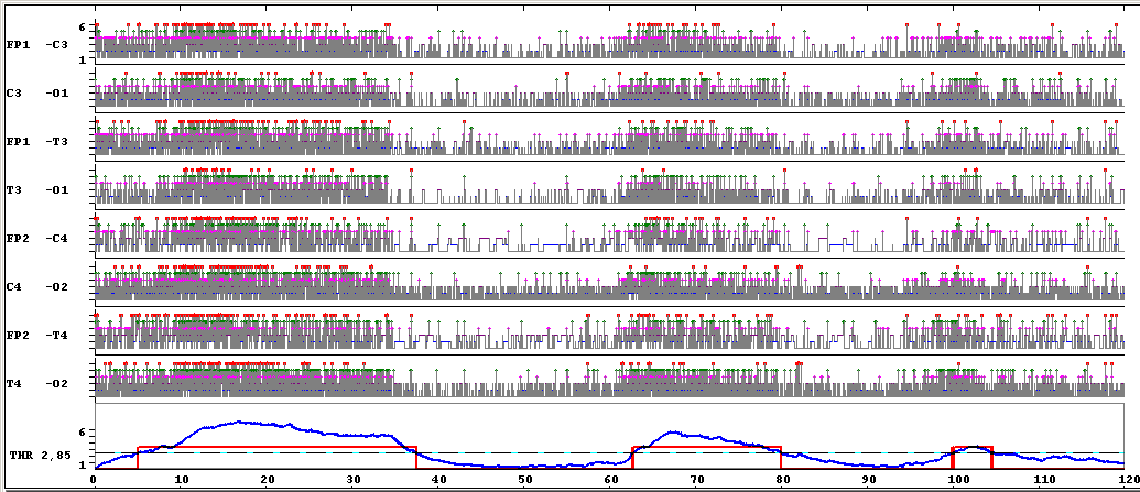 Příklad detekce spánkových stavů novorozence pomocí vyhlazení časových profilů (120 min