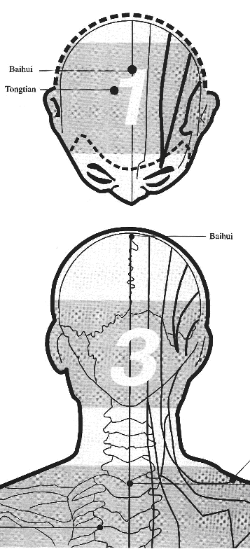 11. Přehled akupunkturních