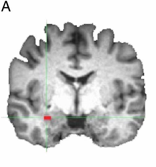 Neural basis of altruism