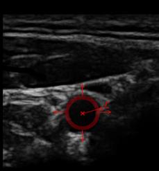 2 /18 /52 SPLAB, BUT Klepnutím Group of Biomedical lze upravit Signal styl Processing předlohy Biomedical sensors design and signal processing Signal processing for computer tomography and