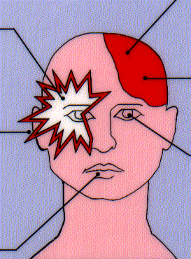 Klinická charakteristika migrény IHS (2003) alespoň 5 atak splňující následující kritéria: Střední až silná, pulzující, unilaterální bolest hlavy v trvání 4-72 hodin, zesilující