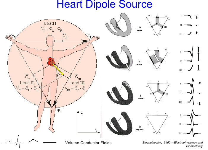 Vektokardiogram