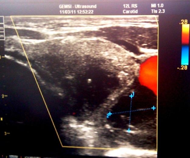 Sekce pro ultrazvukové metody ČSARIM, Sekce regionální anestezie ČSARIM a Klinika anesteziologie, resuscitace a intenzivní medicíny 1.