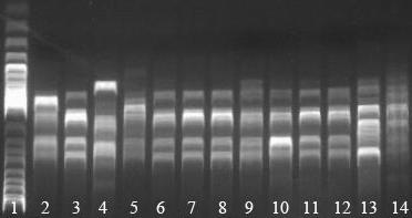 Identifikace bakterií biochemické vlastnosti: zdroje živin, enzymy,