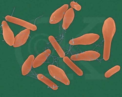 Bakterie rodu Clostridium Rod Clostridium zahrnuje sporulující anaerobní bakterie. Vegetativní formy mají tvar robustních tyčinek (starší kultury bývají Gram labilní), jsou pohyblivé.