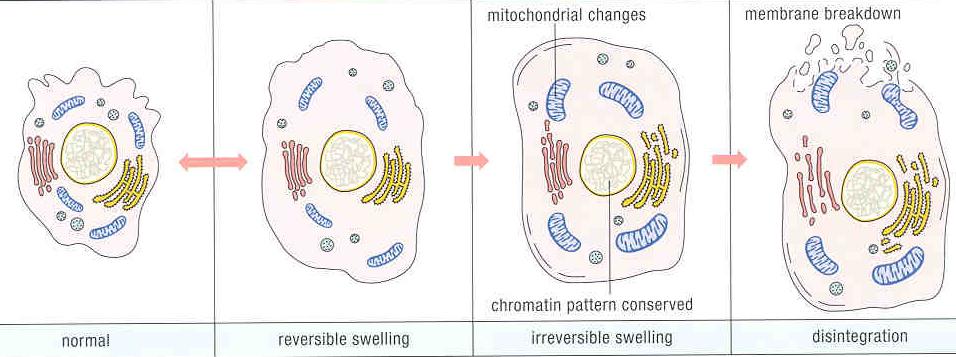 Nekróza II porucha plazmatické membrány a membrán uvnitř bb ztráta zdroje energie (zástava syntézy ATP) narušena distribuce iontů projevy - bobtnání, tvorba vakuol (vakuolární degenerace),