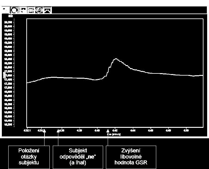 37. Toto je ukázka části grafu, ve kterém byla subjektu položena otázka o blízké osobě. 38. Graf uložte a analyzujte jej. Závěr 39.