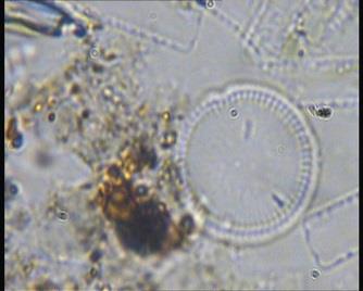 Fytoplankton s dominancí rozsivek A rozsivkový jarně-letní plankton hlubokých horských čistých jezer (Cyclotella spp.