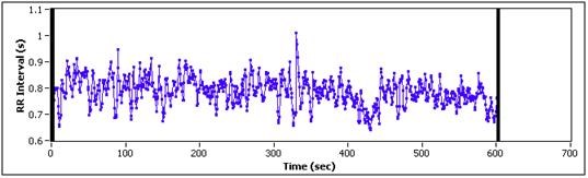 EKG signál příklad dalšího zpracování (HRV)