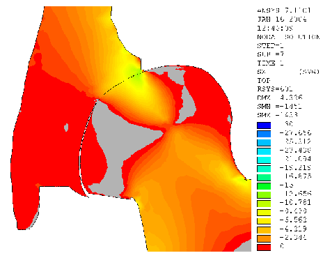 glutaeus pmax = 30,7 MPa Nárůst o 29 MPa 20-ti násobně pmax = 1,5 MPa Stykový tlak na