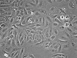 Modely pro studium hojení ran Experimentální model zánětu LPS z Escherichia coli (10-50 µg/ml) TNF-α (10-100 ng/ml)