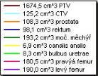 2 Zdroj: Radioterapie Holešov s.r.o. Obrázek 11: Histogram - pacient č.