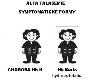 ALFA TALASÉMIE (2) Choroba hemoglobinu H - (HbH) - postižení 3 genů pro řetězce (-, - / -, ) nebo (-, - /, T ) - středně těžká anémie s hemol.