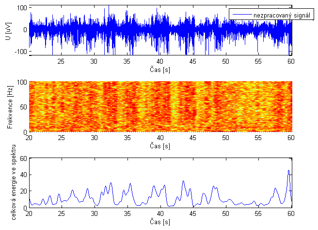 Obr. 6 : Spektrální analýza signálu - spektrogram a časové rozložení energie 3.