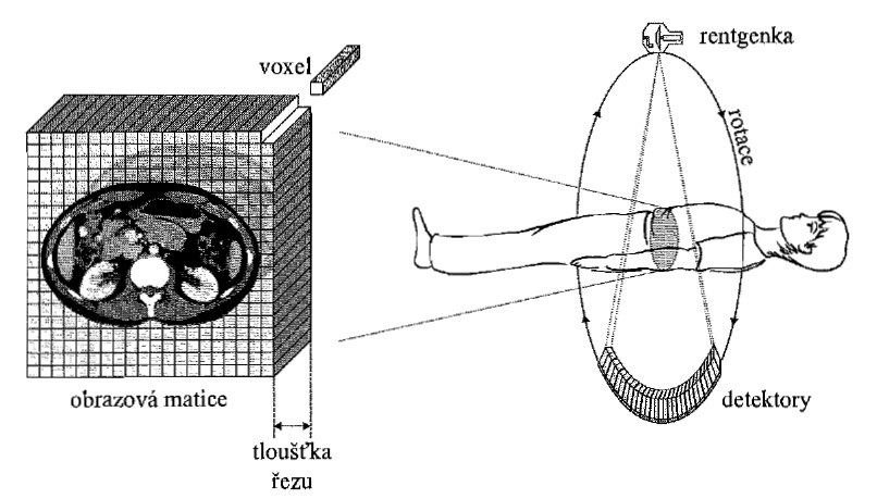 4.2 PRINCIP VÝPOČETNÍ TOMOGRAFIE Výpočetní tomografie je radiodiagnostická zobrazovací metoda, vyuţívající průřezové obrazy tkáňových struktur, které jsou rekonstruovány výpočetní technikou podle