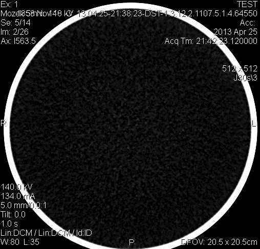 SKEN č. 1 Vyšetřovaná oblast: Hlava (mozek) Pouţitá matice: 512x512 Nastavení napětí: 140 kv Nastavení proudu: 134 ma (CARE DOSE) Efektivní dávka: 1,6 msv Obr.