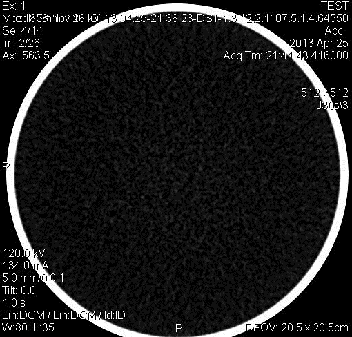 SKEN č. 2 Vyšetřovaná oblast: Hlava (mozek) Pouţitá matice: 512x512 Nastavení napětí: 120 kv Nastavení proudu: 134 ma (CARE DOSE) Efektivní dávka: 1,3 msv Obr.