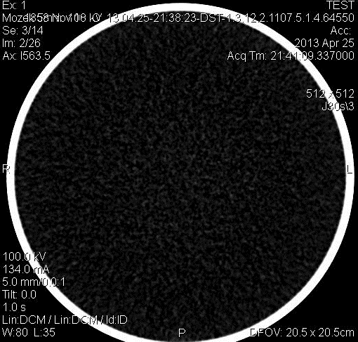 SKEN č. 3 Vyšetřovaná oblast: Hlava (mozek) Pouţitá matice: 512x512 Nastavení napětí: 100 kv Nastavení proudu: 134 ma (CARE DOSE) Efektivní dávka: 0,71 msv Obr.