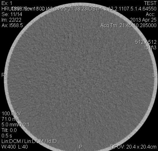 SKEN č. 3 Vyšetřovaná oblast: Hrudník Pouţitá matice: 512x512 Nastavení napětí: 100 kv Nastavení proudu: 71 ma (CARE DOSE) Efektivní dávka: 1,8 msv Obr.