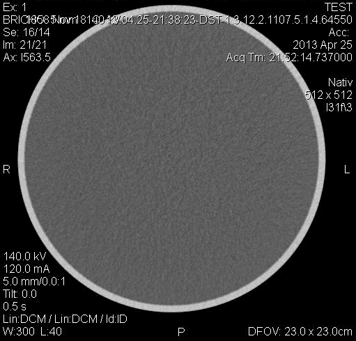 SKEN č. 1 Vyšetřovaná oblast: Břicho Pouţitá matice: 512x512 Nastavení napětí: 140 kv Nastavení proudu: 120 ma (CARE DOSE) Efektivní dávka: 11 msv Obr.