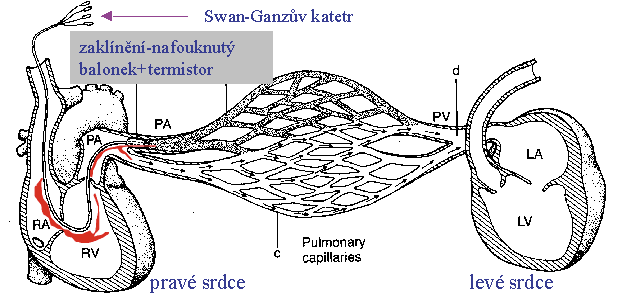 Měření minutového objemu - diluční metody termodiluční metoda: Jediná obecně rozšířená metoda. Pomocí pravostranné katetrizace-swan-ganzův katetr. Do oblasti pr.