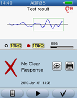 Testy Výsledek testu PASS (Clear Response) Pokud je výsledek testu PASS (Clear Response), je zobrazen pouze graf.