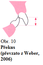 Rozlišujeme skus vertikální (překus/overbite) a horizontální (předkus/overjet). Předkus (Obr.