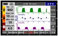 Preoxygenaci ukončíte zvolením a potvrzením položky Off (vypnuto). Nabídka Preoxygenation se zavře, zobrazí se nabídka volby režimů.