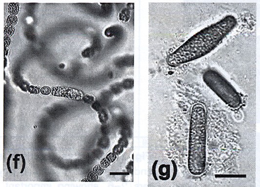 Anabaena - planktic species (Dolichospermum) planktonní, solitární vlákna