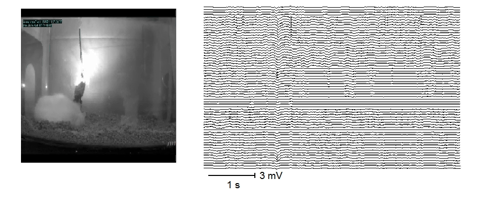 Fast ripples a epilepsie Chronická epilepsie je charakterizována spontánními a