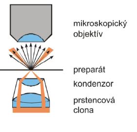 U této metody je zapotřebí použití kondenzoru, který má numerickou aperturu větší nebo shodnou s numerickou aperturou mikroskopu. Apertura vyjadřuje velikost otvoru optické soustavy.